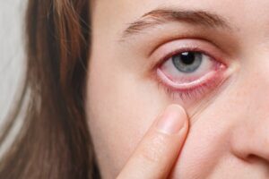 choroby oczu